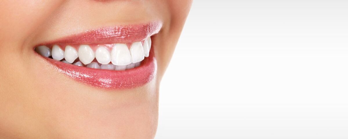 Botox sorriso