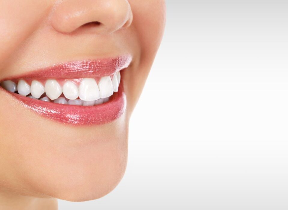 Botox sorriso