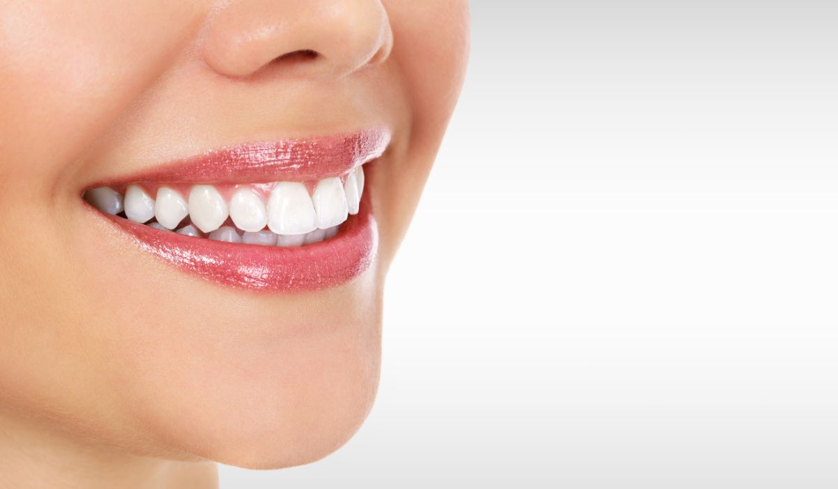 Botox sorriso