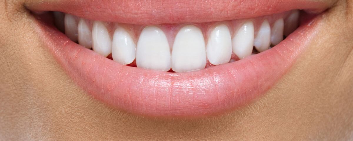Sorriso perfeito