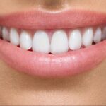 Sorriso perfeito