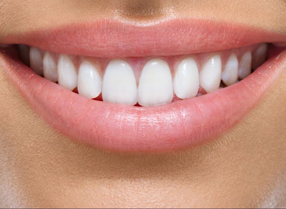 Sorriso perfeito