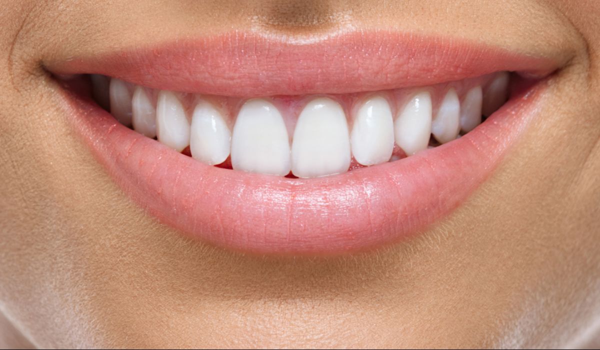Sorriso perfeito